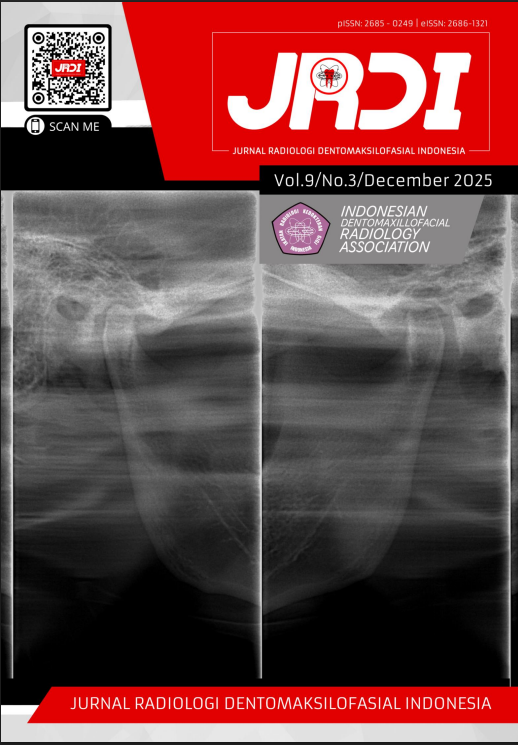 					View Vol. 9 No. 3 (2025): Jurnal Radiologi Dentomaksilofasial Indonesia (JRDI)
				