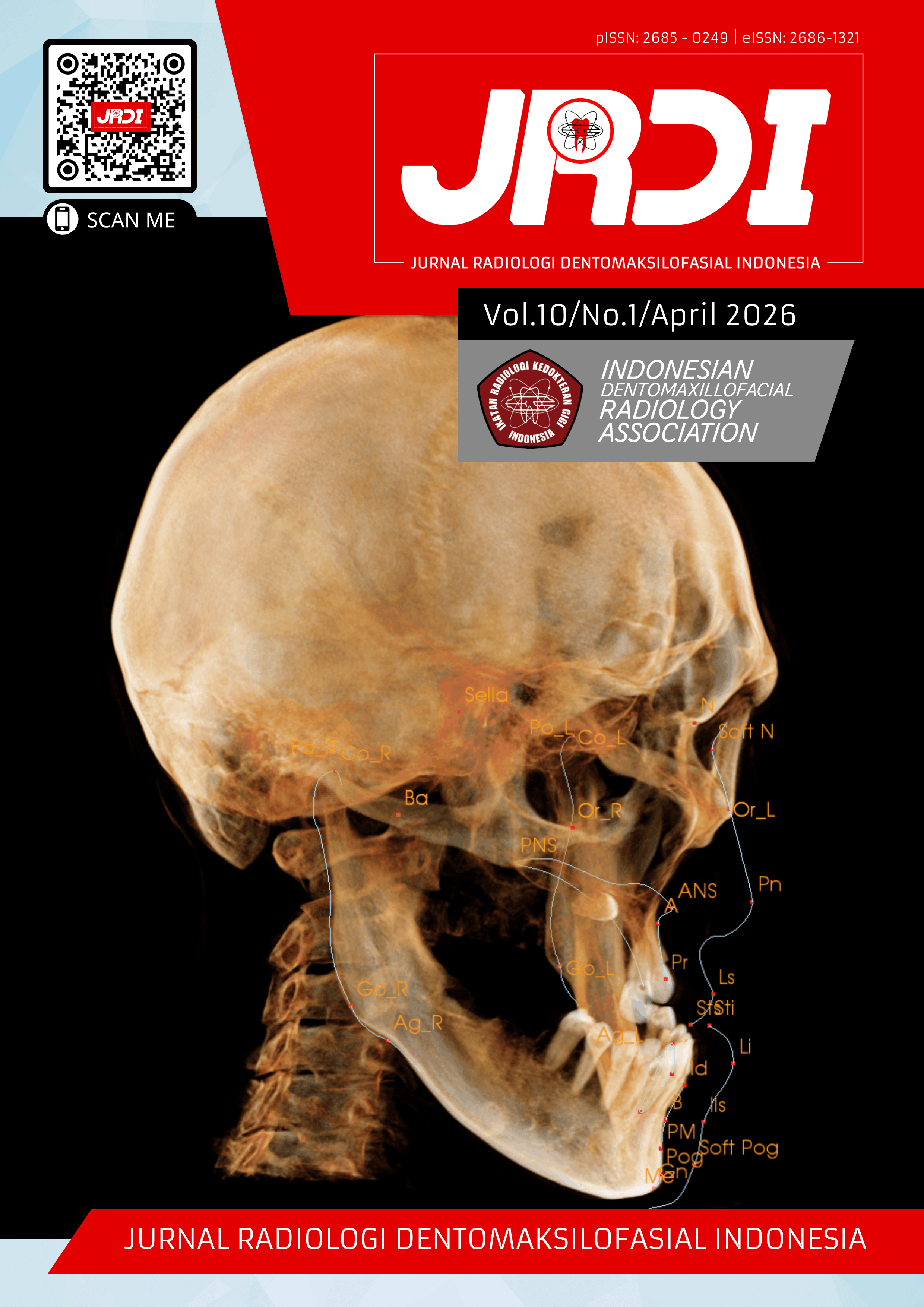 					View Vol. 10 No. 1 (2026): Jurnal Radiologi Dentomaksilofasial Indonesia (JRDI)
				